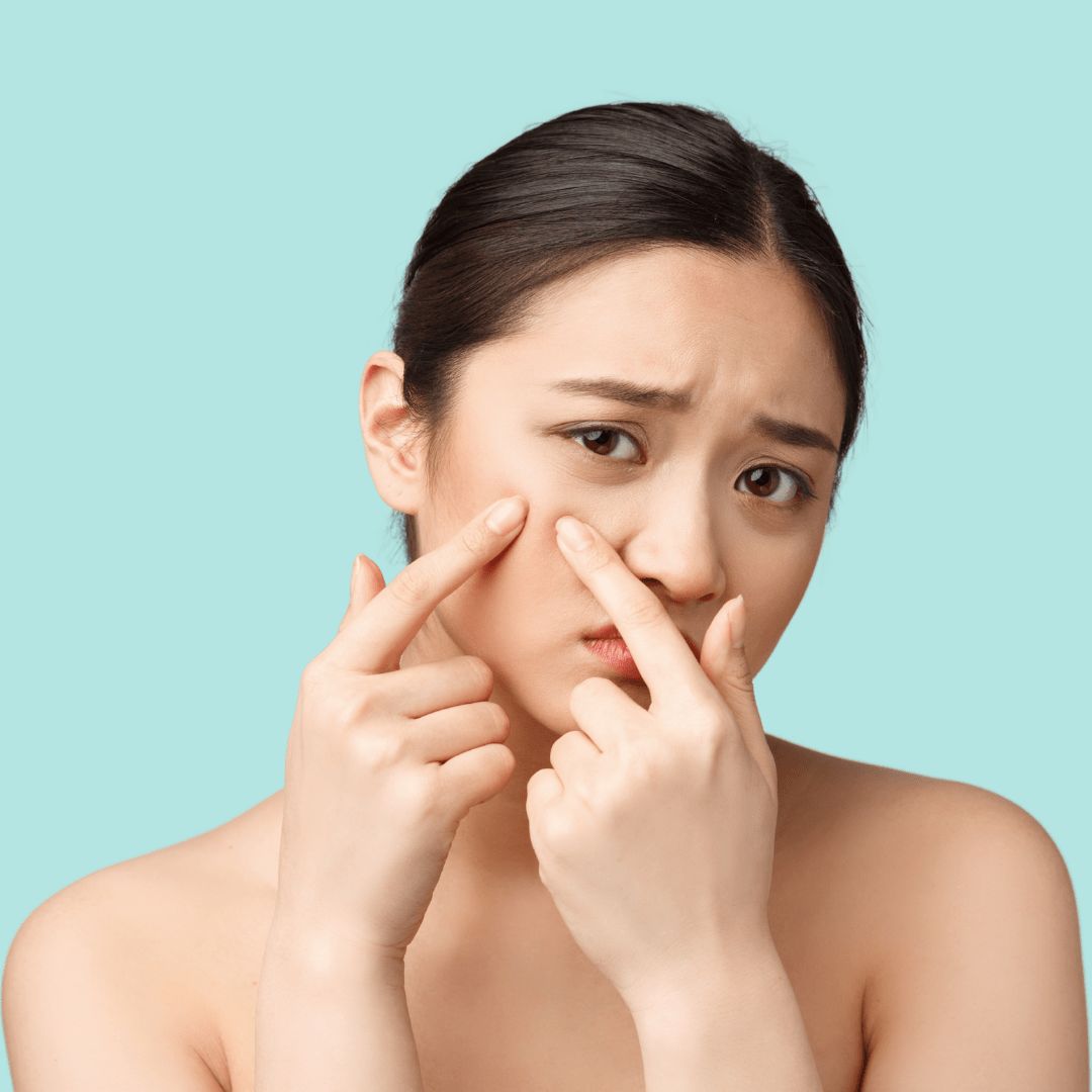 Da mụn viêm không nên xông hơi vì nhiệt độ cao có thể làm tăng viêm