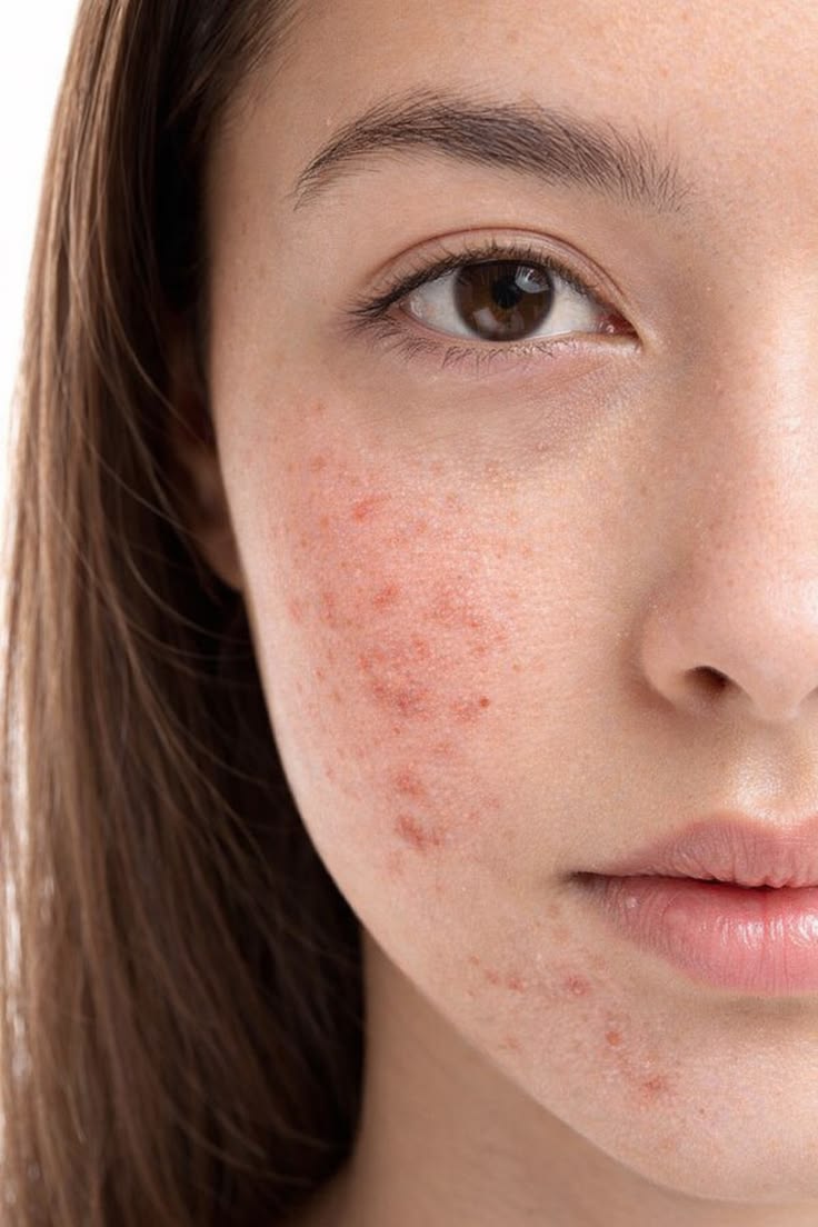 Làn da có thể ghi nhớ tổn thương và phản ứng khác sau mỗi lần viêm hoặc cháy nắng