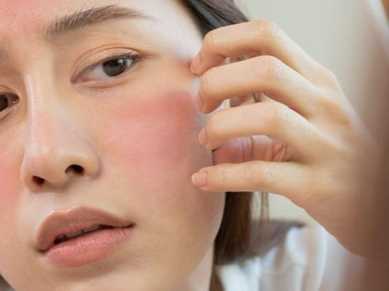 Dưỡng da dịu nhẹ trong tuần hành kinh khi da khô và nhạy cảm