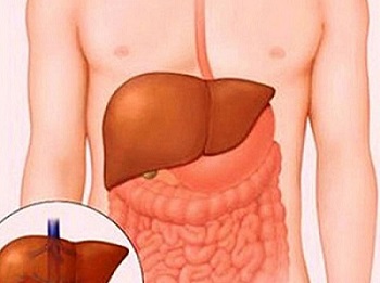 Có nhiều nguyên nhân gây ra mụn ẩn